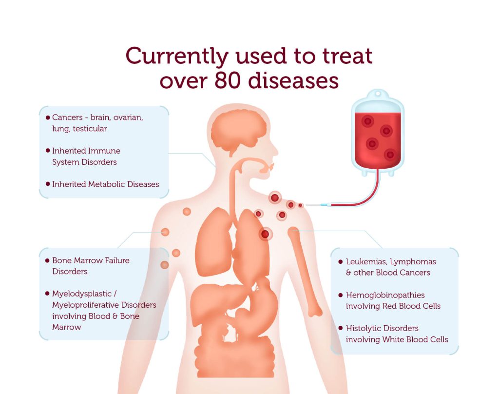 Stem Cell Therapy Explained