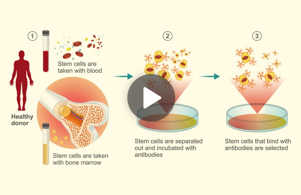 Exploring The Differences Cord Blood Vs Cord Tissue