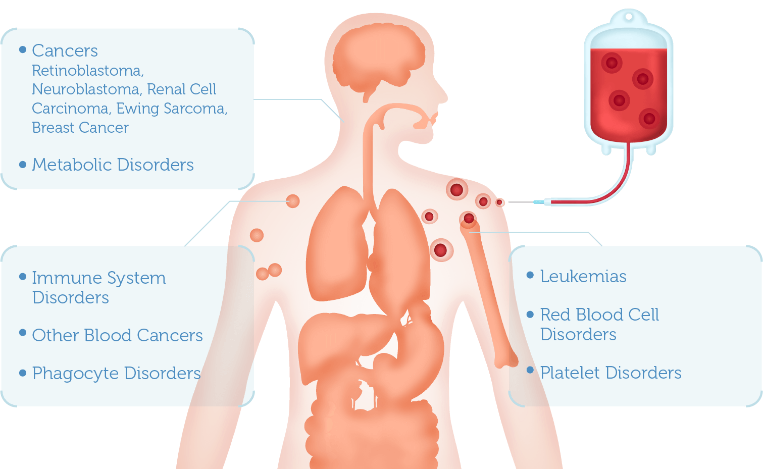 Cord Blood Banking