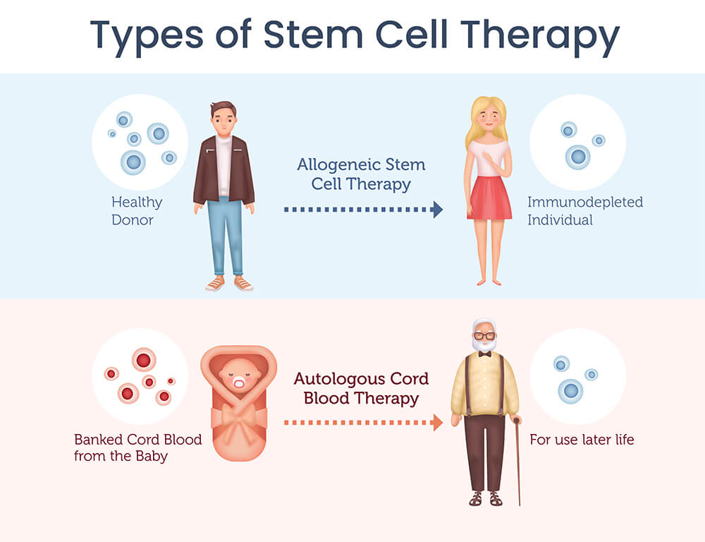 Stem Cell Therapy Explained