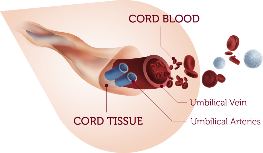 Why Bank Cord Blood?
